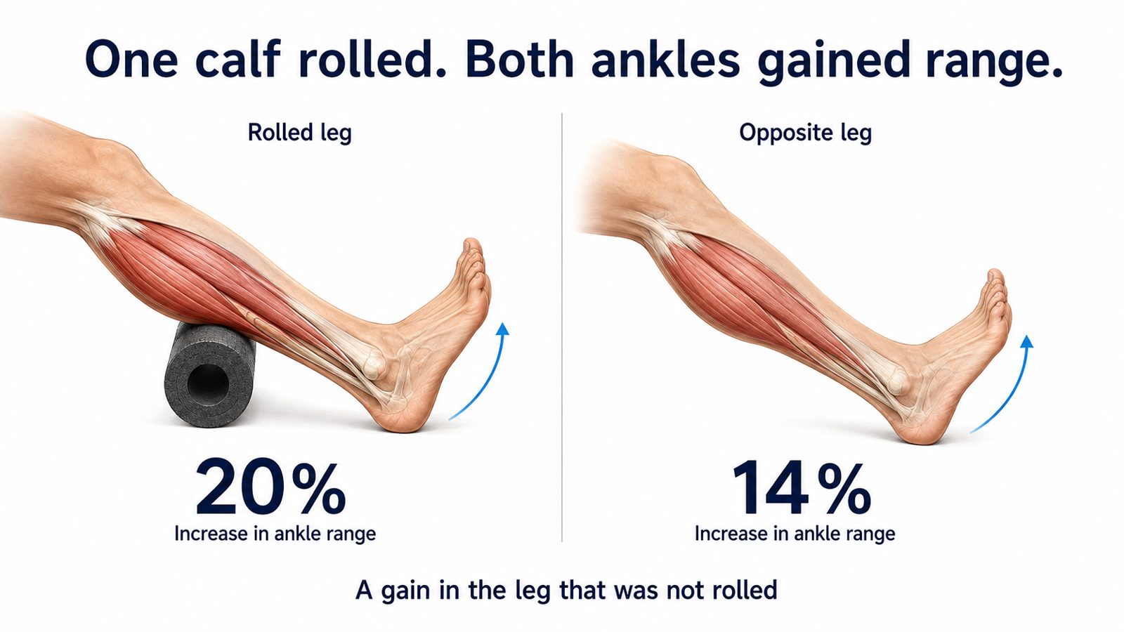 One calf rolled and both ankles gaining range, 20 percent on the rolled side and 14 percent on the other